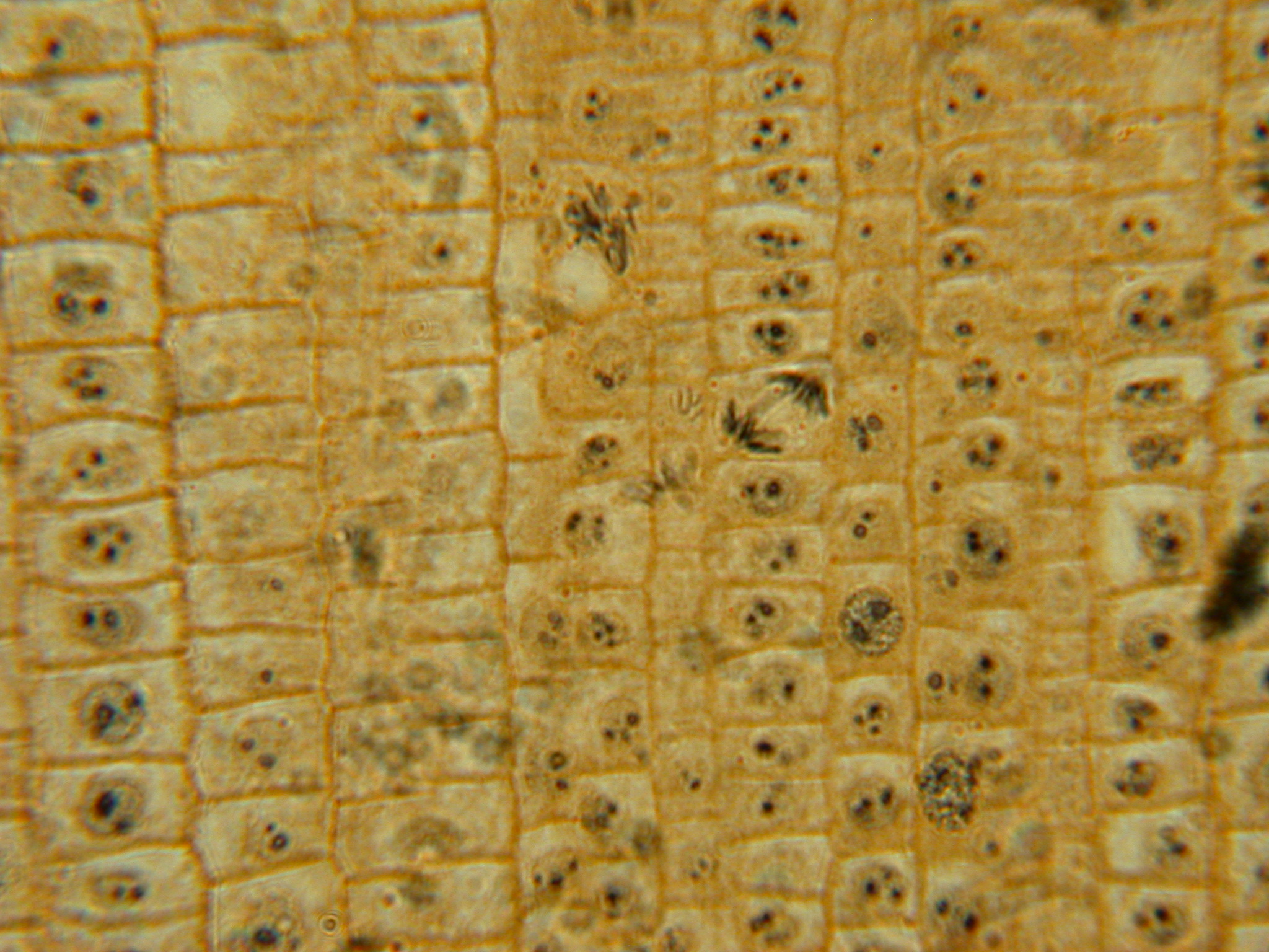 Onion Cells 400x